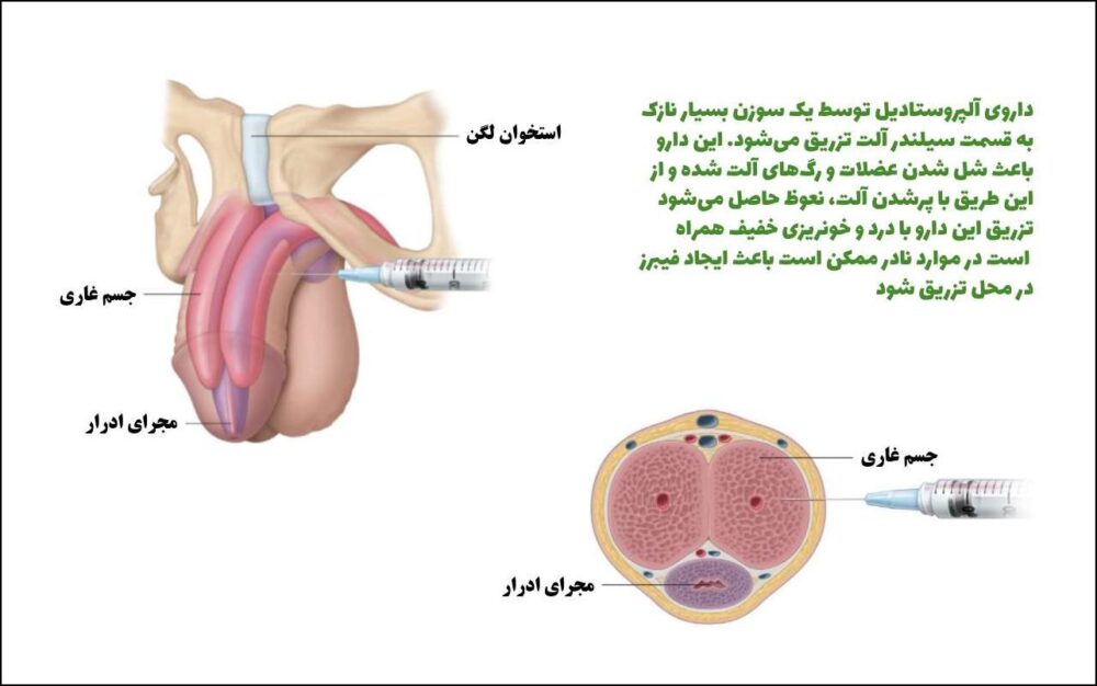 آمپول تزریقی اختلال نعوظ